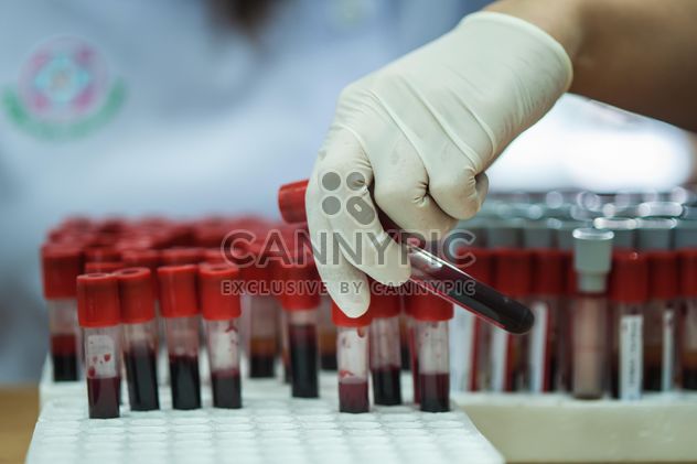Blood check in Medical laboratory - image #343885 gratis