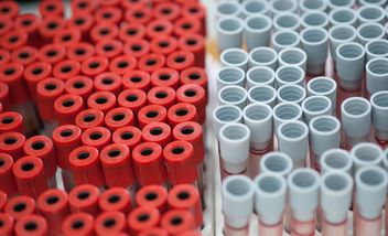 Tubes of blood in plastic rack - Free image #347245