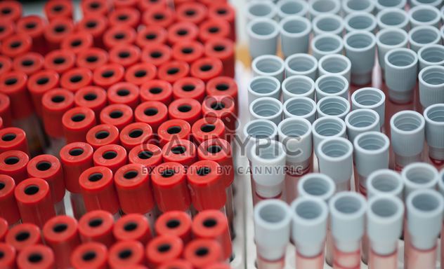Tubes of blood in plastic rack - image gratuit #347245 