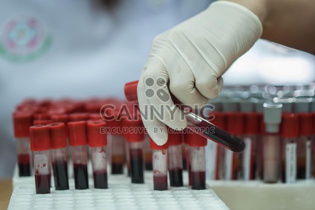 Hand in latex glove holding blood sample tubes - image gratuit #347255 